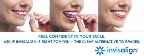 Feel confident in your smile.  Ask if invisalign is right for you ~ the clear alternative to braces
